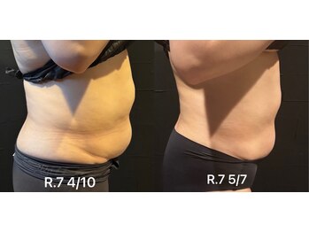 ビトタン 倉敷本店(+美to鍛)/レモンボトルお腹