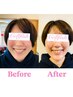 【頭蓋骨＆小顔矯正】お顔の左右差・歪み・たるみ・むくみに即効◎（50分）