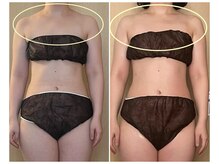 ココア(CoCoa)/活性リンパ洗浄