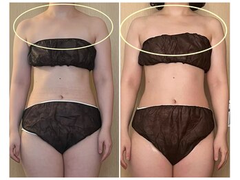 ココア(CoCoa)/活性リンパ洗浄