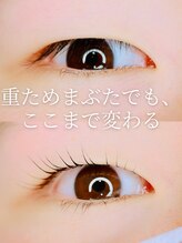 タイトプラス(tyto+)/重ためまぶたでもぱっちり上向き