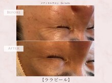 ビベル 八木店(Bebelle)/３回