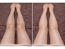 ルネル(Lunelle)/自信の持てる脚へ♪