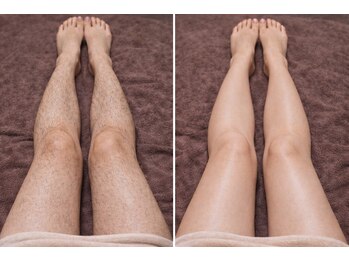 ルネル(Lunelle)/自信の持てる脚へ♪