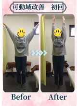 アミーゴ整体院/ビフォーアフター