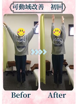 アミーゴ整体院/ビフォーアフター