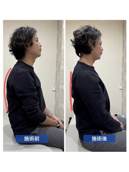 ウェルミナ鍼灸接骨院の写真/【イオン守山店から車で1分】手強い首・肩こりを集中改善☆辛い肩こりは“ウェルミナ鍼灸接骨院”へ!