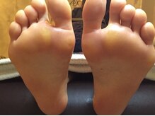 ココン フワット(cocon fouato)/角質ケア施術後　銀座/新橋/東京