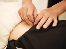 ジェイペック鍼灸整骨院/鍼灸施術【肩こり・腰痛に】