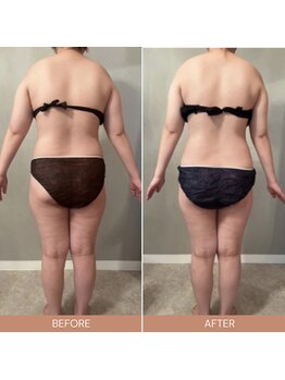 リファラ 光の森店(REFALA)/【痩身/30代女性】約3ヶ月の結果