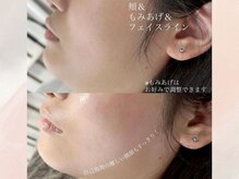 エマイミー 品川(EmayMie)/1部位から選べるフェイシャルWAX