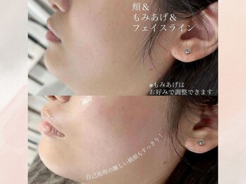 エマイミー 品川(EmayMie)/1部位から選べるフェイシャルWAX
