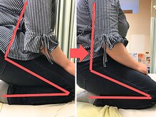 杉本接骨鍼灸院/膝の症状例：施術を受けた方の声