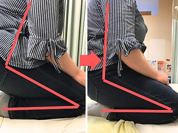 杉本接骨鍼灸院/膝の症状例:施術を受けた方の声