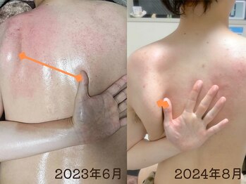 ボディーリセット 勝どき/【before/after】整体マッサージ