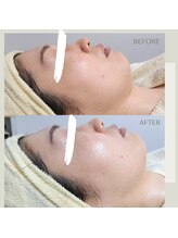 エミナル バイ ニコドット(Eminal by nico.)/フェイシャル小顔・筋膜リリース