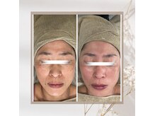 当店がこだわり厳選した美容商品も多数◎ホームケアでこの変化♪