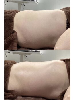 レイジュ(reiju)/【サーモシェイプ】　腹部　1回