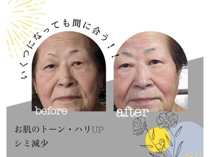 ピュアタイム 3.5.8の写真