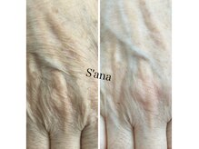 サナ 久が原 千鳥町(S’ana)の雰囲気（ハーブピーリング＋オイルマッサージでお手元がスッキリ。）