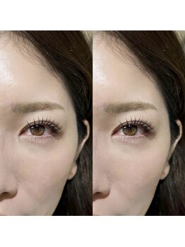 エジェ(eje)/ラッシュリフト