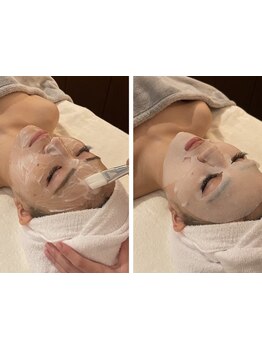 ホウレイ線・たるみ改善！予防ケア