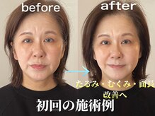 ラ アクサル(la.akthar)