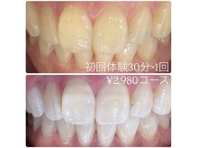 ホワイトニングルーム 横浜店(Whitening Room)/セルフホワイトニング/横浜