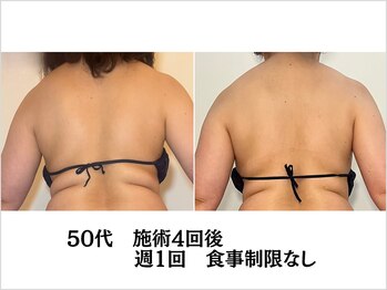 ルナ クレッシェンテ(Luna crescente)/むくみや姿勢の悪さも解消[痩身]