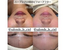 サロンドゥルシェル(salonde_le ciel)の雰囲気（本気で肌質改善をしたい方は、ハーブリプロがオススメです！）