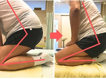 杉本接骨鍼灸院/膝の症状例:施術を受けた方の声