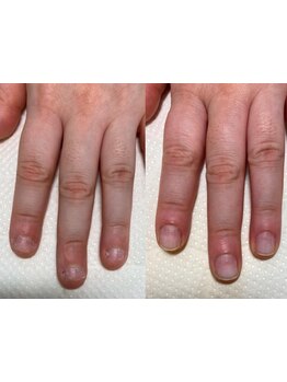 爪の悩みを解消できる（ケア含む）