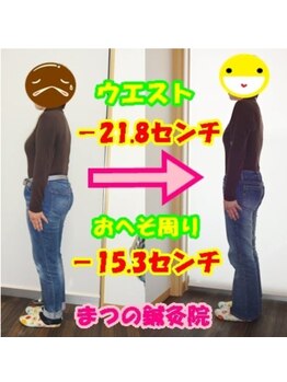まつの鍼灸院/身体の厚みがかなり薄くなった