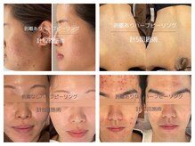 ライフサロン 恵比寿(Life Salon)