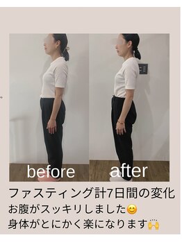 ヴィアス(Vias)/最高のデトックス