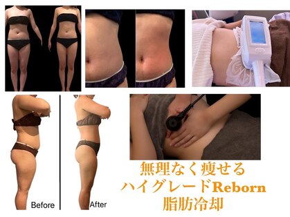 ティパニボーテ(Tipani Beaute')の写真