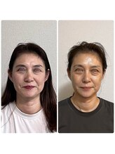 ステラ 武蔵小杉(Stella)/美骨エステ B/A