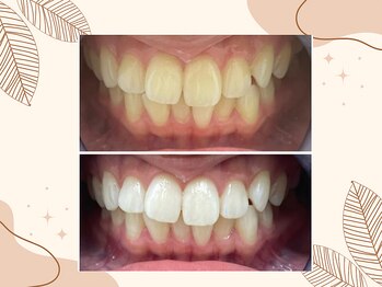 ホワイト つくば店(WHITE)/ビフォーアフター