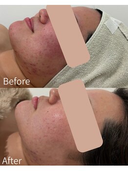 シーズ ザ デイ 熊本店(Seize the day)/艶肌ララピール☆