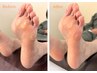 【つらい足裏の痛みに】角質ケア＋オイルフットマッサージ90分　11000円