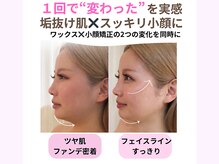 エルドットサナ(L.sana)