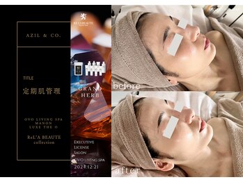 オーヴォ リビングスパ アネックス マノン(OVO LIVING SPA annex MANON)/【施術事例】定期肌管理