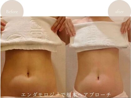 ルモラビューティー 水天宮前店(LUMORABEAUTY)の写真