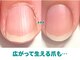 キラリネイル(KIRARINAIL)の写真