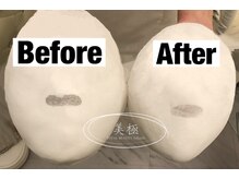 美極 トータルビューティー(美極 TOTAL BEAUTY)/恵比寿/小顔コルギ/エステ/