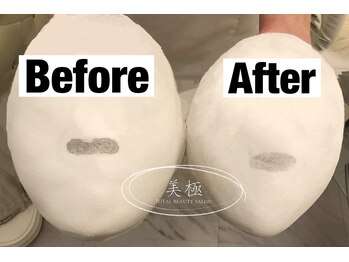 美極 トータルビューティー(美極 TOTAL BEAUTY)/恵比寿/小顔コルギ/エステ/