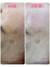 ビューティーサロン キャンディ 海老名(Candy)/