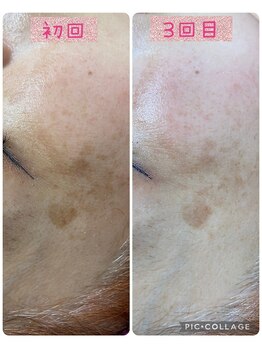 ビューティーサロン キャンディ 海老名(Candy)/