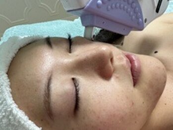 リュクス(LUXE)の写真/【当店が自信をもってお勧めする肌育成！】トラブルに巻き込まれない元気な肌作り☆最高級光フェイシャル♪