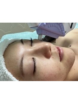 ハリツヤをUPしたい